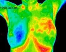 FLIR Interpretation of Thermography